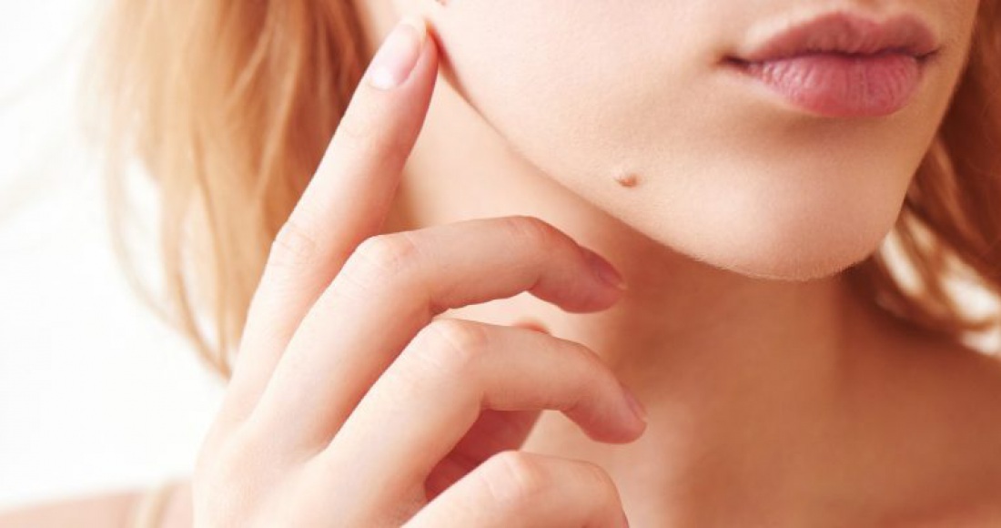 Jak pielęgnować blizny na twarzy po usunięciu pieprzyka?