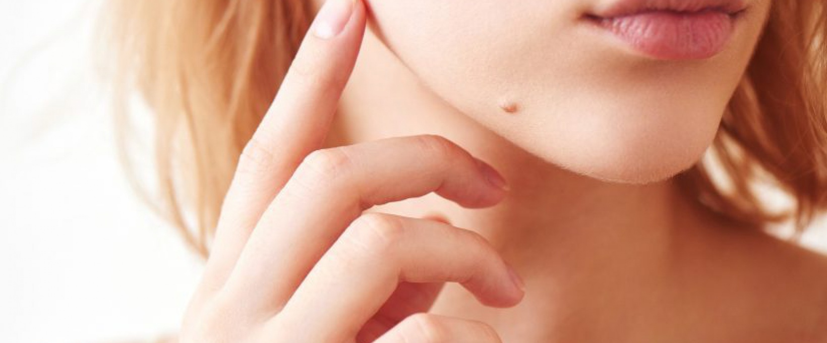 Jak pielęgnować blizny na twarzy po usunięciu pieprzyka?